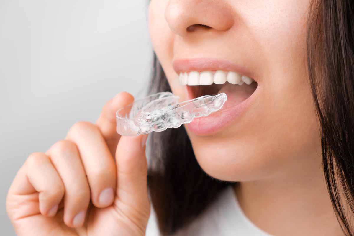 Modern Orthodontics 2022 and beyond Modern Orthodontics 2022 and beyond