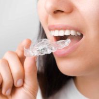 Orthodontics Stock Photo 03