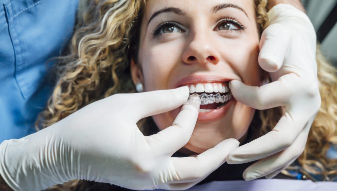 Types of Removable Orthodontic Appliances
