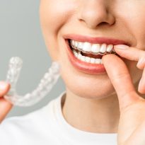 A young woman does a home teeth whitening procedure. Whitening tray with gel